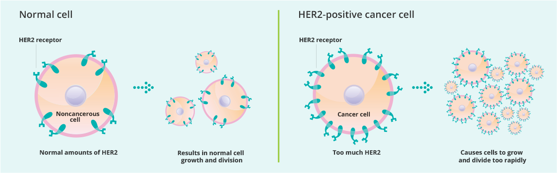 Graphic showing how HER2 receptors impact noncancerous cells compared to cancerous cells